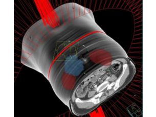 Pinnacle&sup3; The speed of VMAT delivery. The excellence of Pinnacle&sup3;.