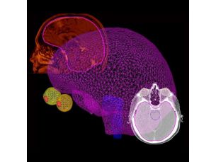 Pinnacle³ Drag and drop organ modeling enhances workflow