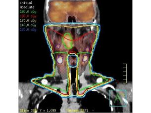 Pinnacle³ Automated multi-modality image registration