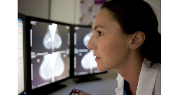 IntelliSpace Breast | Philips