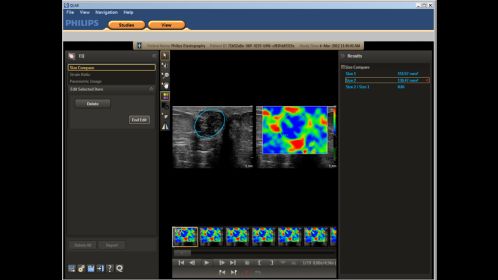 Philips Qlab Cardiac Analysis Hcnoctn145 の詳細を表示