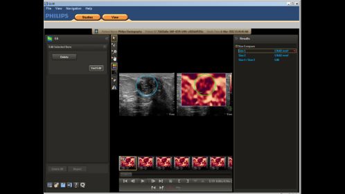 Philips Qlab Cardiac Analysis Hcnoctn145 の詳細を表示