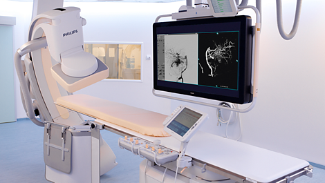 AlluraClarity Sistema intervencional de rayos X de baja dosis