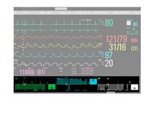 Horizon Trends Pantalla de medición de tendencia