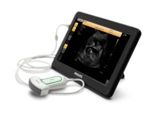 VISIQ Not just a new ultrasound, a new vision