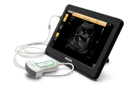 VISIQ Not just a new ultrasound, a new vision