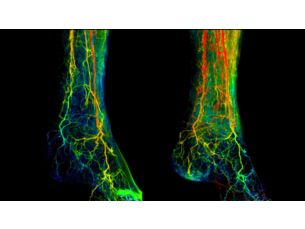 2D Perfusion 