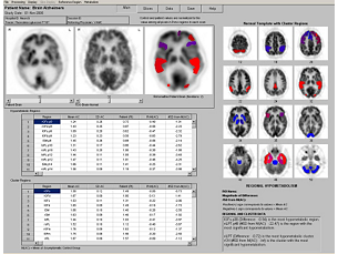 NeuroQ 3.0 Analyse-Tool für PET-Scans