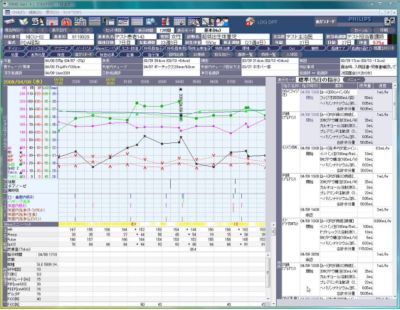 Philips 重症・急性期患者情報システム Fortec ACSYS 集中治療患者情報