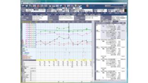 重症・急性期患者情報システム Fortec ACSYS 