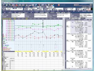 重症・急性期患者情報システム Fortec ACSYS 集中治療患者情報管理システム