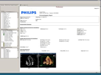 Philips Media Manager Serial Number