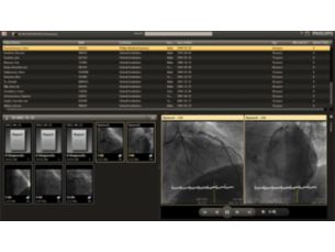 Xcelera visualizador enterprise de cardiolog&iacute;a