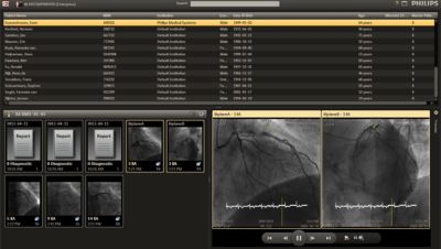 Details van Philips Xcelera Cardiology Enterprise Viewer bekijken
