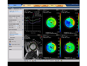 Cardiac Explorer心脏管理器 磁共振工作流程解决方案