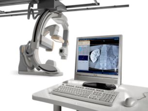 XperCT Dual 介入治疗过程中的快速、高分辨率椎形束CT