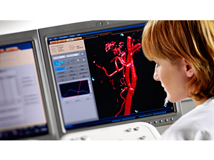 Allura 3D Software de análisis de rayos X