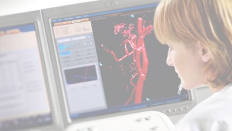 Allura 3D Software de an&aacute;lisis de rayos X