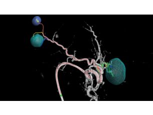 OncoSuite 