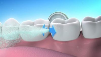 teeth airfloss