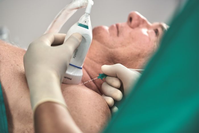 Onvision guidance solution for regional anesthesia from Philips and B. Braun