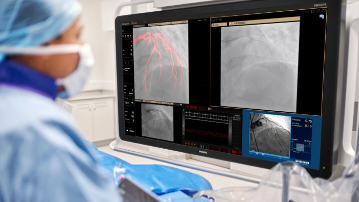 Philips, Azurion, image guided therapy, intervention, x-ray, technology, next-generation, iFR