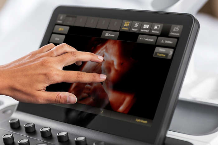 Philips, ultrasound, EPIC, imaging, diagnosis, 3D imaging