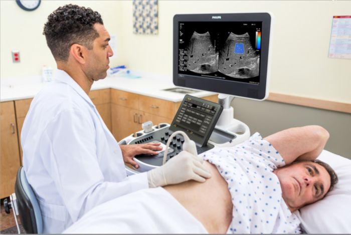 Philips ElastQ Imaging shear wave elastography