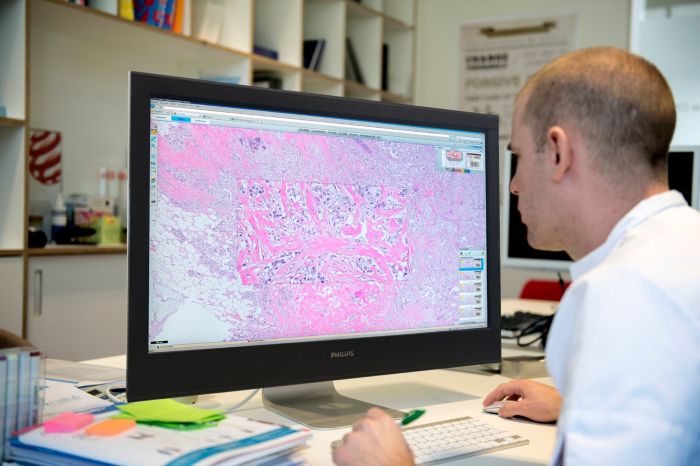 digital pathology accurate diagnosis cancer computational, artificial intelligence, machine learning