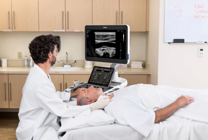 Philips Ultimate Solution for Vascular Assessment