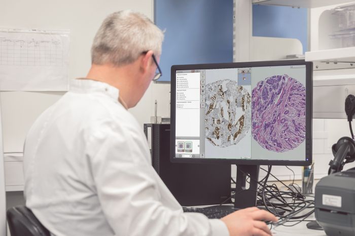 Philips, Xplore, Digital Pathology, computational pathology, informatics, cancer, oncology