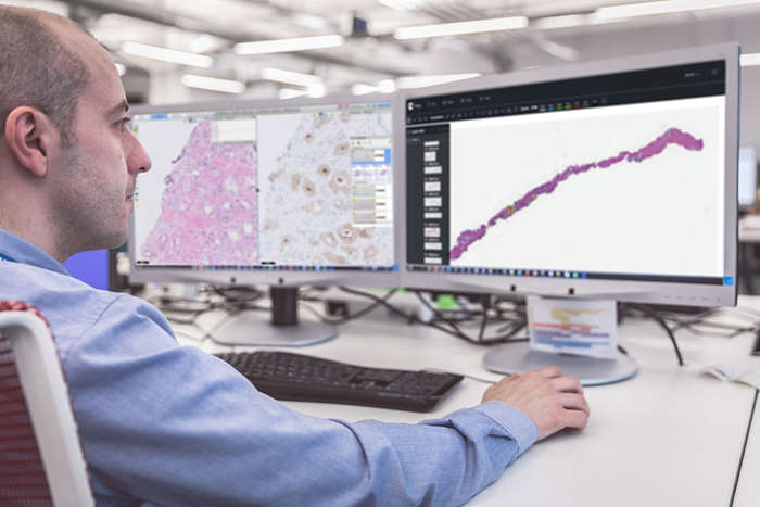 Philips and Paige bring Artifical Intelligence (AI) to clinical pathology diagnostics