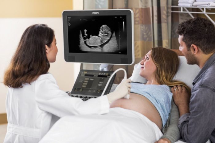 Philips eL18-4 ultrasound transducer PureWave