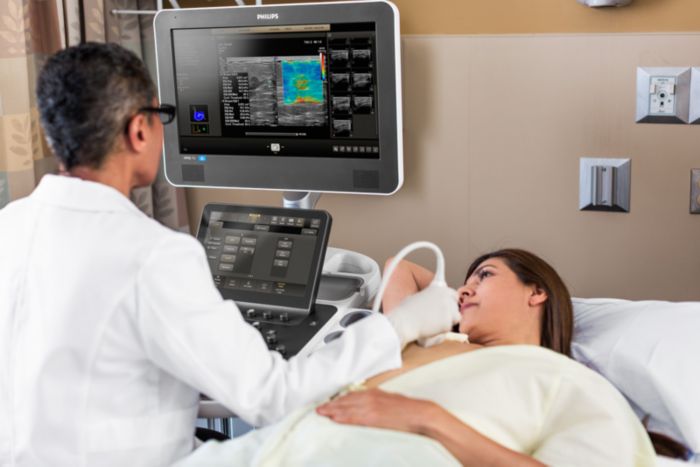 Philips ultimate ultrasound solution for breast assessment