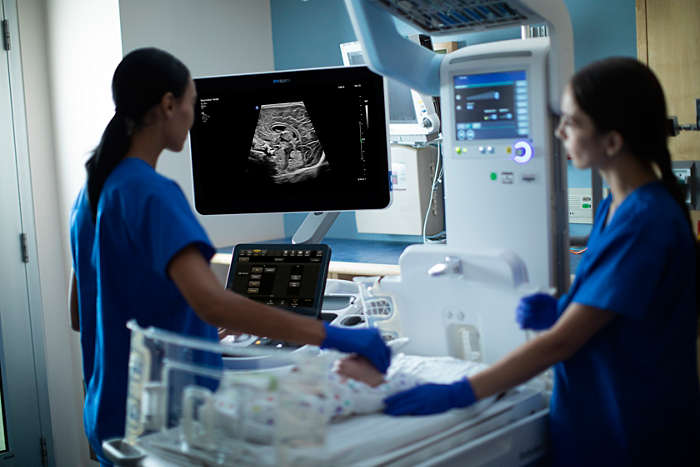 Philips ultimate ultrasound solution for pediatric assessment solution