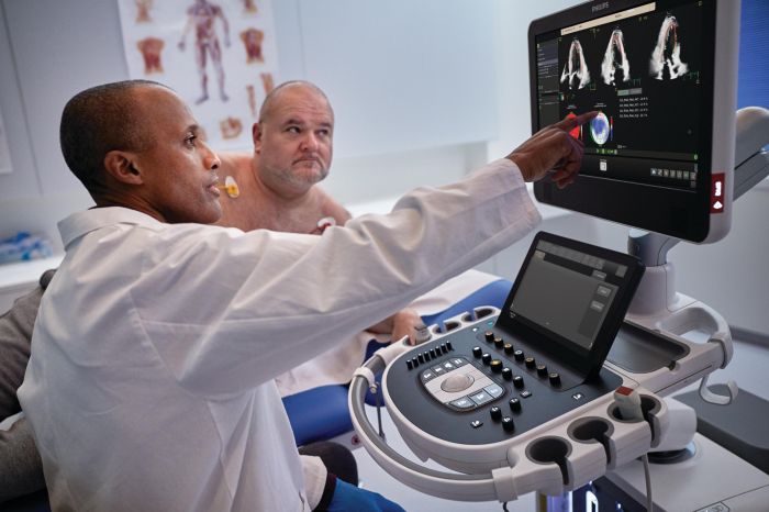 Transcend Plus Ultrasound system in use