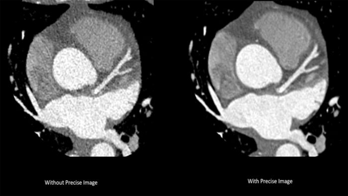 A complex cardiac scan taken with a CT5300 scanner