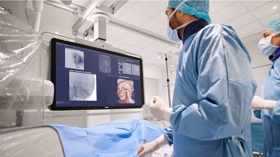 Azurion with 3d treatment view
