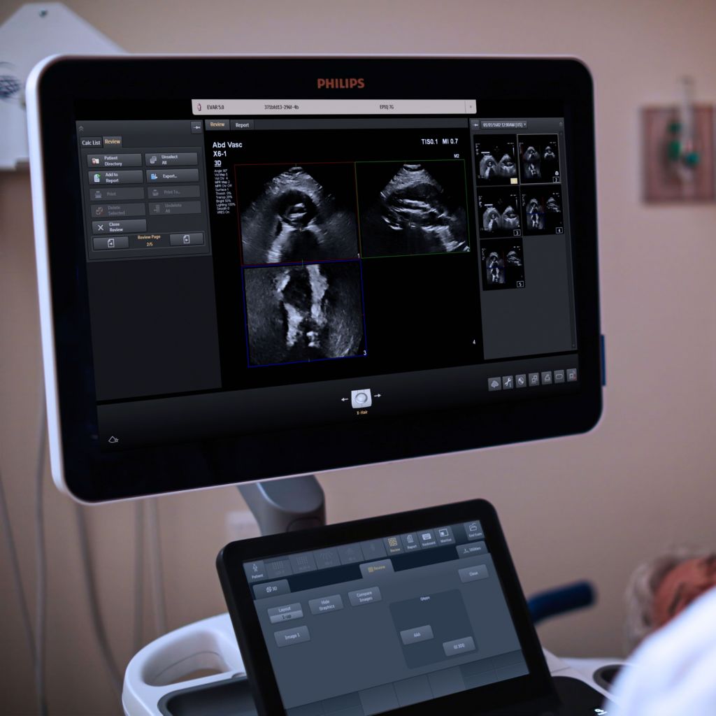 Epiq ultrasound screen