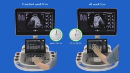 Auto Measure Abdomen video