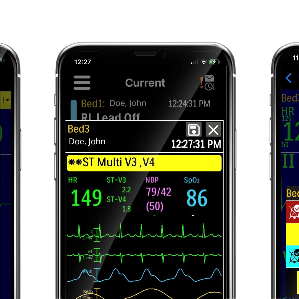 Notification with Care Assist