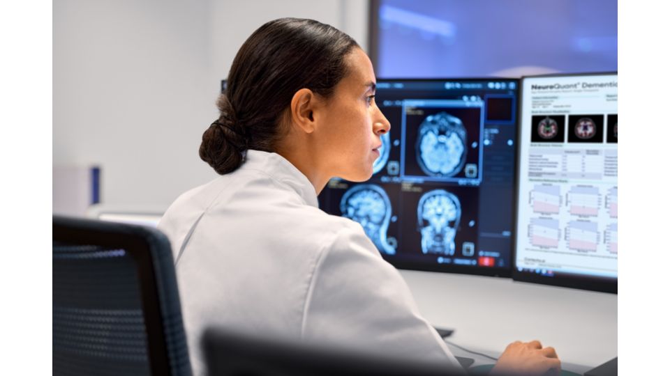 Clinician views Cortechs.ai neuroimaging analytics