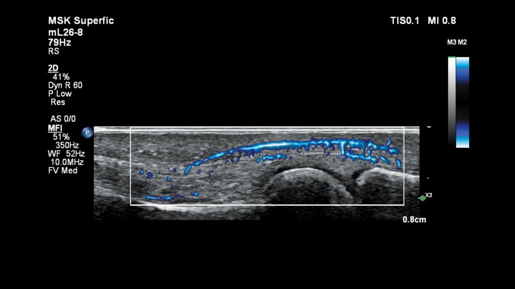 Finger ultrasound