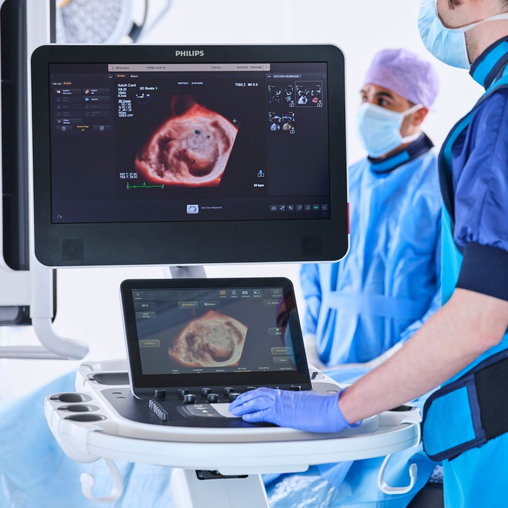 Echocardiography philips