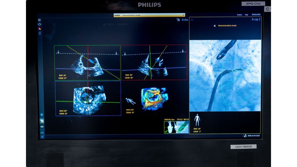 DeviceGuide screen content