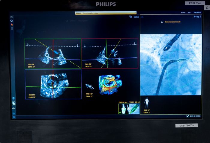 DeviceGuide screen content