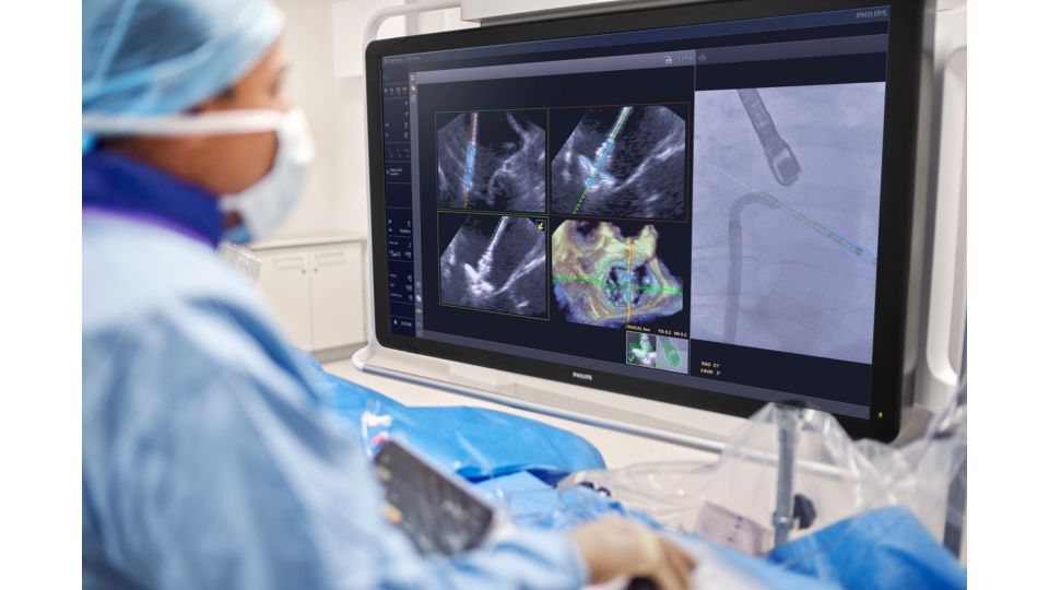 DeviceGuide in use with EchoNavigator