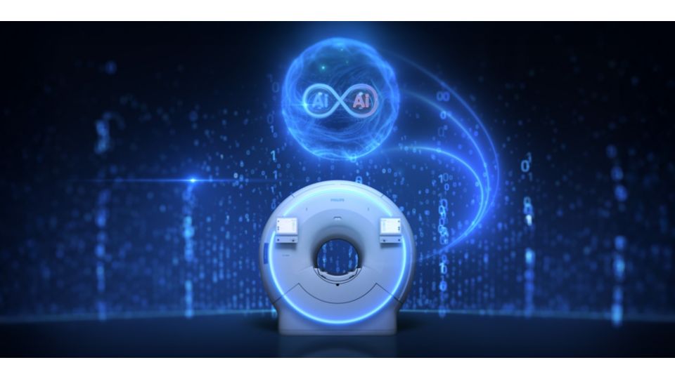 Dual AI engines in SmartSpeed Precise