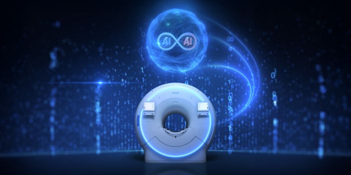 Dual AI engines in SmartSpeed Precise