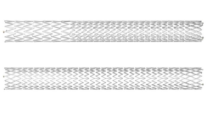 Duo Venous Stent System